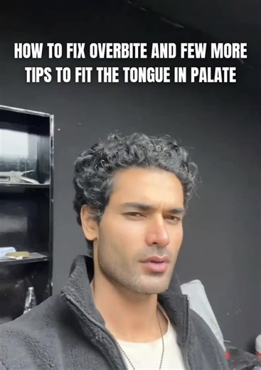 Fix Overbite Without Cope Methods