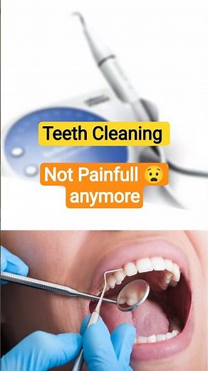 🦷 Is Dental Scaling Harmful The Truth Explained by Dr Parth Shah