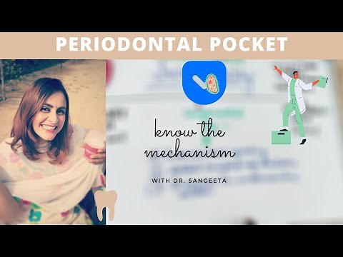 periodontal pocket (carranza)