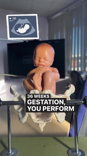 Understanding the Fetal Presentation in Pregnancy Ultrasound