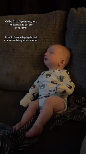 Understanding Cri Du Chat Syndrome in Infants