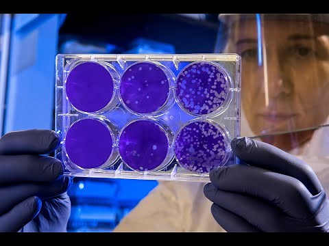 Nanofiltration: Difference from Ultra- and MicroFiltrations - Bonus Lecture (Lec114)