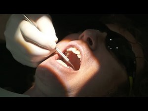 PULLING TEETH