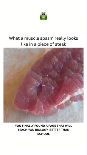 BIOLOGY | MEDICAL | HEALTH on Instagram: "A muscle spasm is a sudden, involuntary muscle contraction that can feel like a cramp, twitch, or tight knot. It often happens without warning and can range from mildly uncomfortable to sharply painful. Common triggers include dehydration, muscle fatigue, nerve irritation, or electrolyte imbalances—particularly low levels of potassium, calcium, or magnesium. Spasms can last anywhere from a few seconds to several minutes. While they’re usually harmless, t