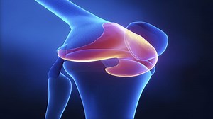 What to Expect From Knee Replacement Surgery Outcomes