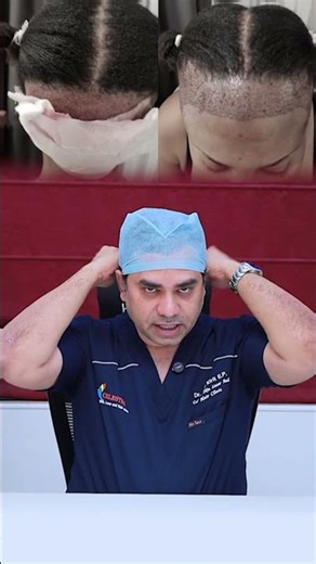 How Hair Transplant Is Done for Women? | #ytshorts #healthtips #hairtransplant #femalehairtransplant