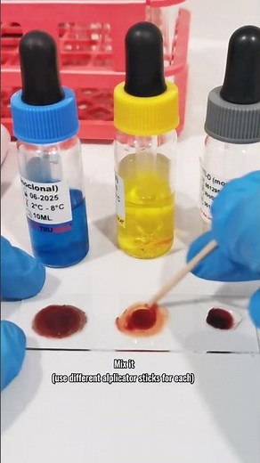 Blood typing procedure #mls #cls #medtechstudent #blood #bloodtype