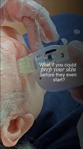 POV: you just found out what's happening under your skin during a Belotero Revive treatment 😳✨