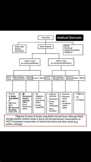 ♦️Ascitic Fluid Analysis & Causes of Ascites . Medical Osmosis 👈👈👈 . #Ascites #medicalosmosis #MRCEM #mrcpuk #medical #UKMLE #antpsychotics #mbbs #bds #NEET | Medical Osmosis