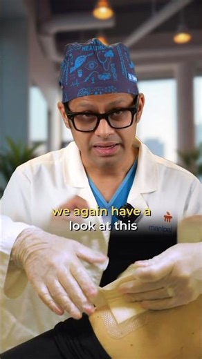Had a joint replacement surgery… or planning one? 🦵⚠️ #JointReplacement #PostSurgeryCare