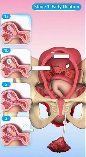 The 3 Stages of Labor: What Really Happens During Birth 👶🏥