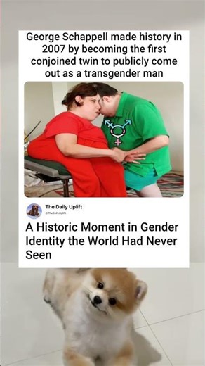 the first time conjoined twins were known to identify as different genders