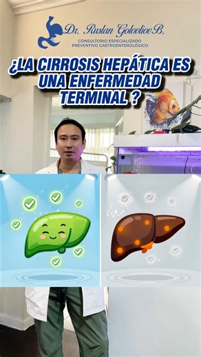 😔 Muchos creen que la cirrosis es sinónimo de final, pero eso no es cierto 💪. Con diagnóstico temprano y seguimiento médico, es posible controlarla y mejorar la función hepática 🌿. Cambiar hábitos, alimentarse bien y tratar la causa hacen la diferencia 💉. ¡Tu hígado puede estabilizarse! 🌞 #SaludHepatica #CuidadoDelHigado #CirrosisControlada #Gastroenterologia #Prevencion #SaludNatural | Dr. Ruslan Golovliov, Gastroenterólogo y Endoscopista Bariátrico