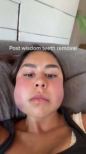 Her Face Is Going To Explode!🤯😳💥 #fyp #teeth #dentistry #braces #health #reaction