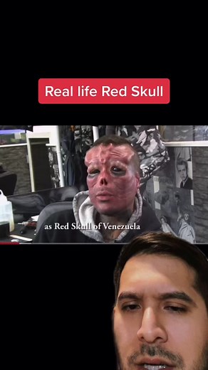 Real Life Red Skull Transformation and Nose Removal