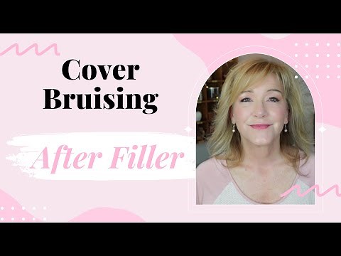 Covering Bruising after Filler