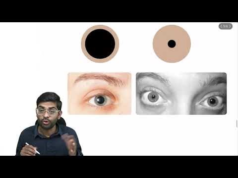 Miosis & Mydriasis — Clinical Concept Made Easy | Dr. Pawan nagar