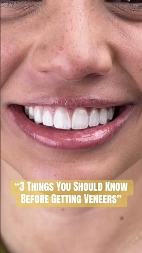 Do Veneers Ruin Your Teeth? Here’s the Truth