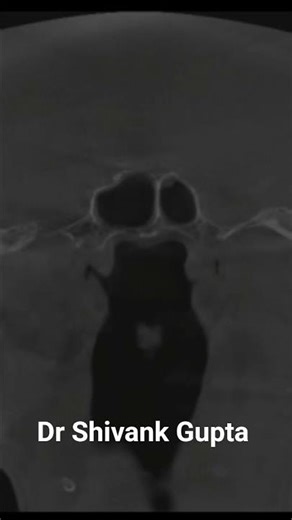 👉 Which CBCT View Is This? 99% Get It Wrong 😳 #viral #trending #guess #cbct #face #head #shortsfeed