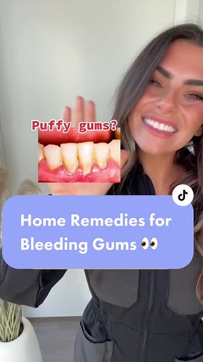 Effective Home Remedies for Bleeding Gums