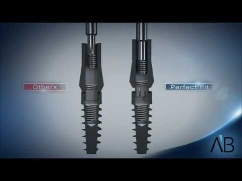 AB Dental Implants- Perfect Fit Technology