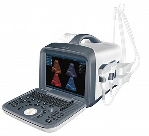 [Hot Item] Medical Imaging Portable Ultrasound Scanner