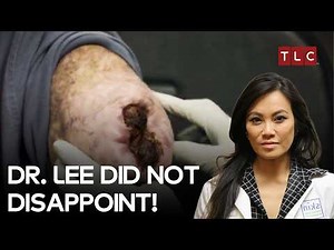 He has many hopes with Dr. Lee | Dr. Pimple Popper S2 E4