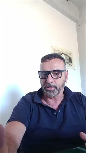 3600 Grafts FUE Hair Transplant in Istanbul–Natural Hairline and Balanced Density 🇮🇹#hairtransplant