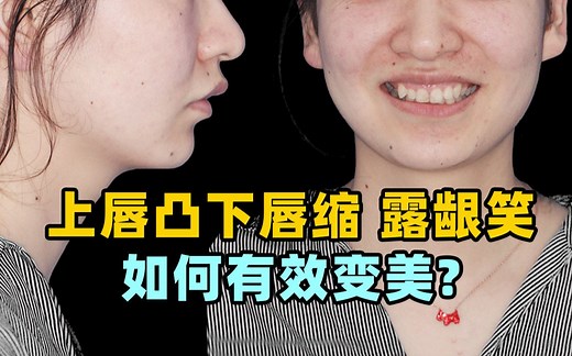 怎么回事！上嘴唇怎么会凸这么多！家人们谁都懂呀！