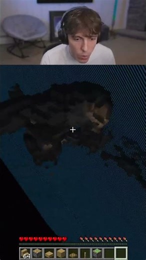 drdonut discovers new Xray