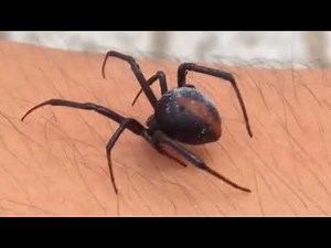 セアカゴケグモに噛まれてみた