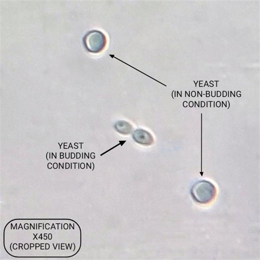 YEAST MICROORGANISM UNDER COMPOUND LIGHT MICROSCOPE