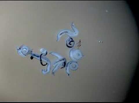 Schistosoma mansoni: effects of praziquantel