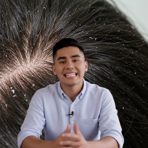 HOW TO GET RID OF DANDRUFF: The Natural Trick That DOES Work
