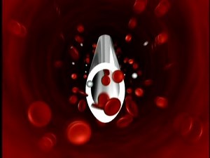 Venipunctures on Neonates