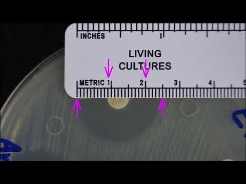 Kirby Bauer Reading results