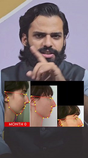 4.6M views · 80K reactions | This will CHANGE your FACE SHAPE  | #reels #face #attractive #female #couple #personality #health #image #boy #practice #technique #doctor #dentist #body #healthylife #fit #help #growth #development #information #facts #reelkrofeelkro #fbreels #facebookreels | Manvendra Singh Chauhan | Facebook