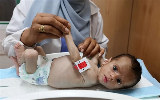 Why children are starving so much faster than adults in Gaza