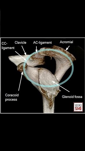 Superior Shoulder Suspensory Complex (SSSC) Explained 🦴 #ortho #anatomy #meded #medicaleducation