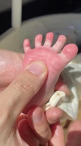 177K views · 213 reactions | Your feet started out like this…禮  A...