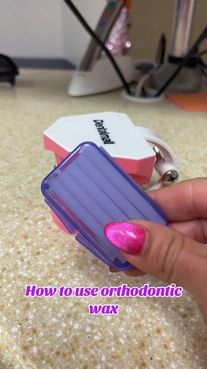 How to Effectively Use Orthodontic Wax