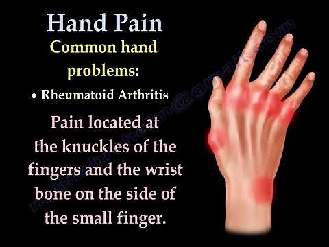 Hand and Finger Pain: Common Causes and Symptoms Explained