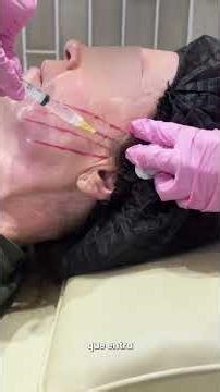 Anesthesia for threads!