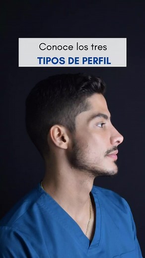 Tipos de Perfil: Plano, Cóncavo y Convexo