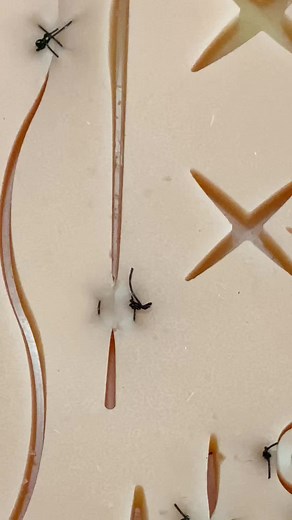 Understanding Horizontal Mattress Suture Techniques