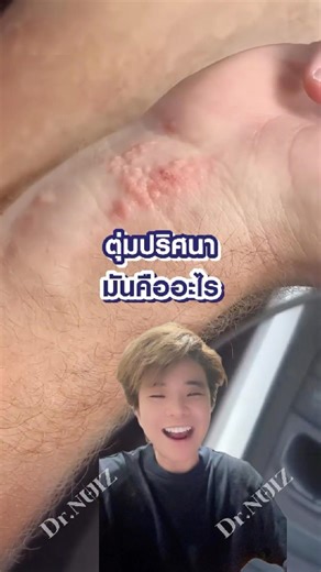 Mysterious bumps! What are they? 😰 #Health #DrNui #Surgeon