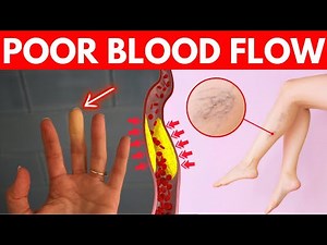12 Causes Of Poor Blood Circulation To Be Aware Of