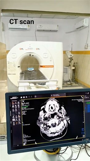 Ncct Brain 🧠 #ctscan #shorts #machine #youtubeshorts #radiology