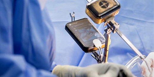 New handheld device brings precision hip replacements to Charleston