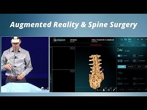 Augmented Reality and Spine Surgery | Live Demonstration with Dr. Chris Hills | St. John's Health